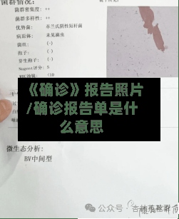 《确诊》报告照片/确诊报告单是什么意思-第2张图片