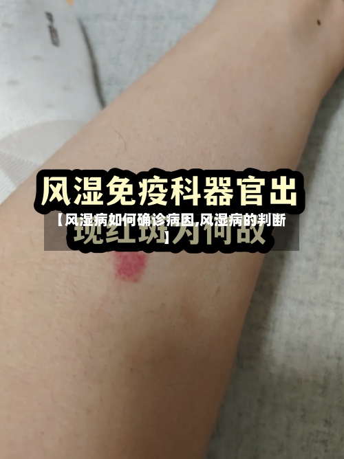 【风湿病如何确诊病因,风湿病的判断】-第3张图片