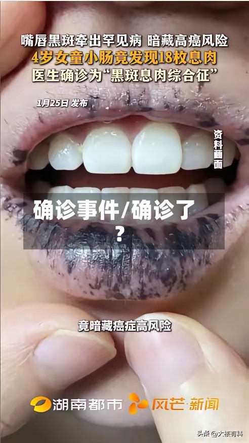 确诊事件/确诊了?-第2张图片