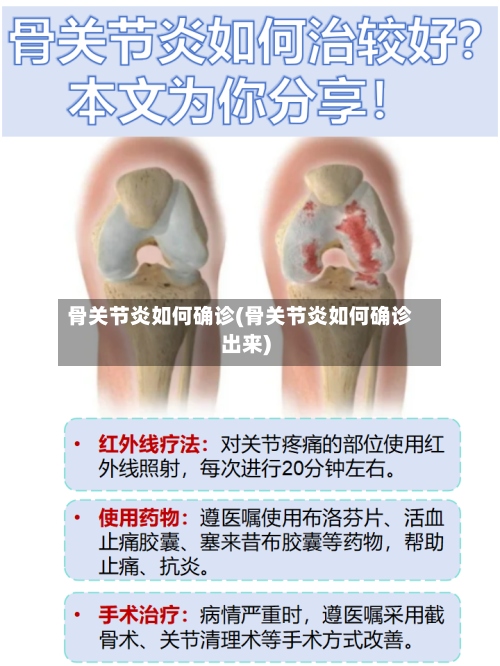 骨关节炎如何确诊(骨关节炎如何确诊出来)-第2张图片