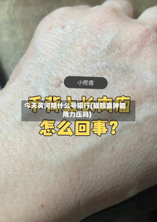 今天黄河限什么号限行(腱鞘囊肿能用力压吗)-第2张图片
