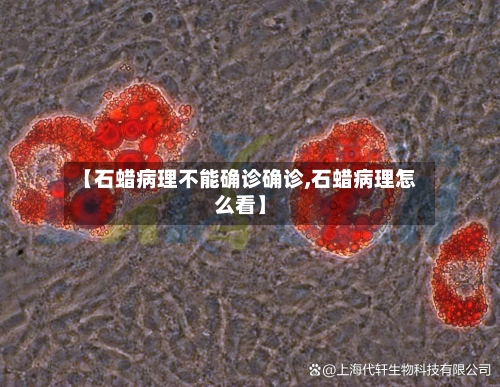 【石蜡病理不能确诊确诊,石蜡病理怎么看】