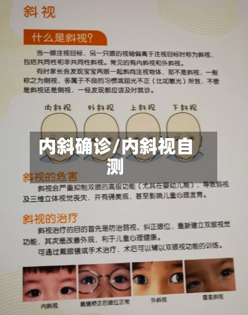 内斜确诊/内斜视自测