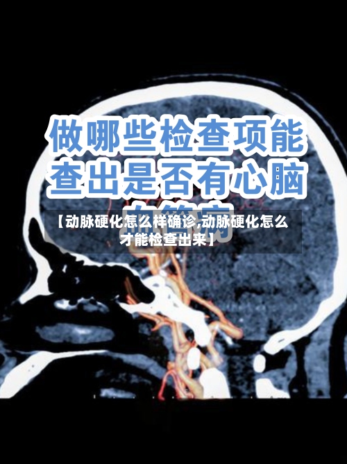 【动脉硬化怎么样确诊,动脉硬化怎么才能检查出来】