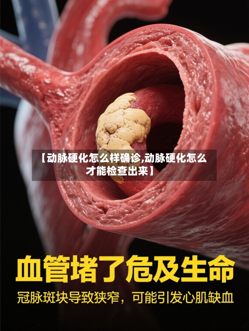 【动脉硬化怎么样确诊,动脉硬化怎么才能检查出来】-第3张图片