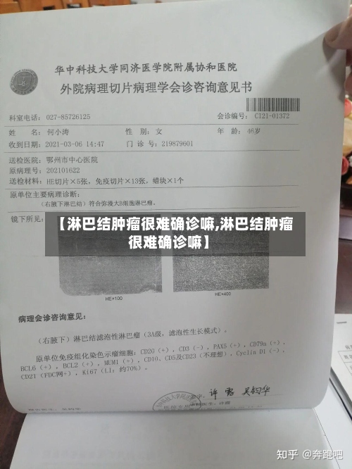【淋巴结肿瘤很难确诊嘛,淋巴结肿瘤很难确诊嘛】