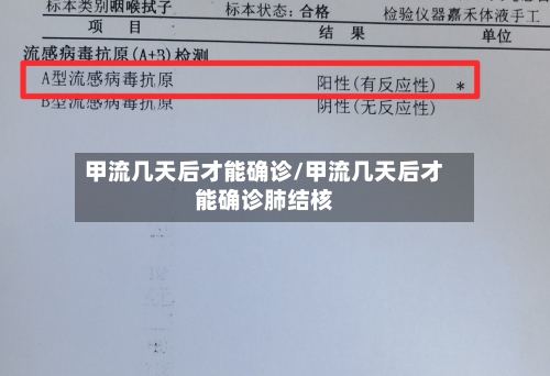 甲流几天后才能确诊/甲流几天后才能确诊肺结核