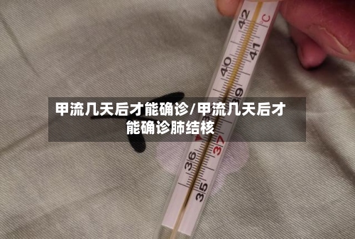 甲流几天后才能确诊/甲流几天后才能确诊肺结核-第2张图片