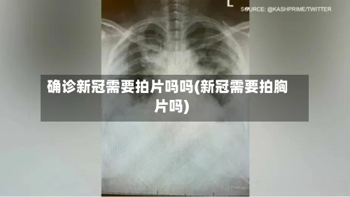 确诊新冠需要拍片吗吗(新冠需要拍胸片吗)