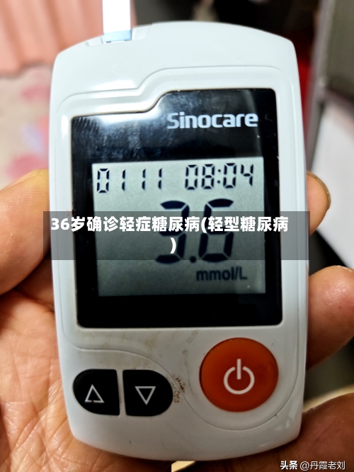 36岁确诊轻症糖尿病(轻型糖尿病)-第3张图片