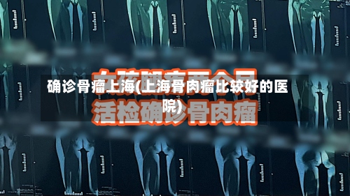 确诊骨瘤上海(上海骨肉瘤比较好的医院)-第2张图片