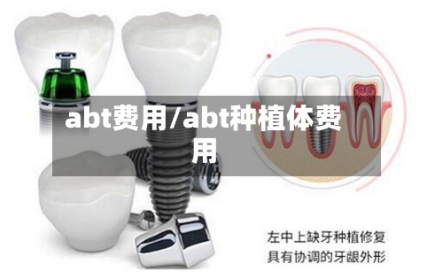 abt费用/abt种植体费用