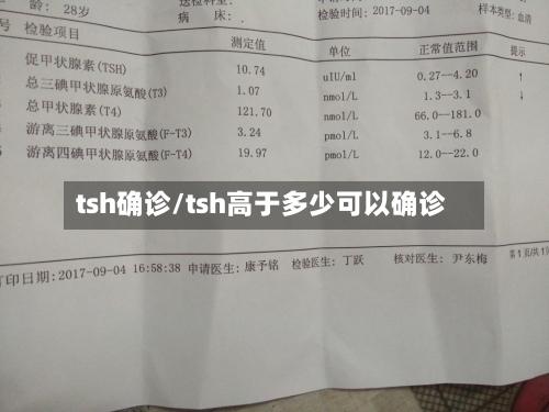 tsh确诊/tsh高于多少可以确诊
