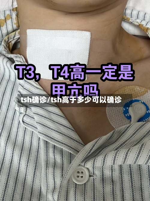 tsh确诊/tsh高于多少可以确诊-第2张图片