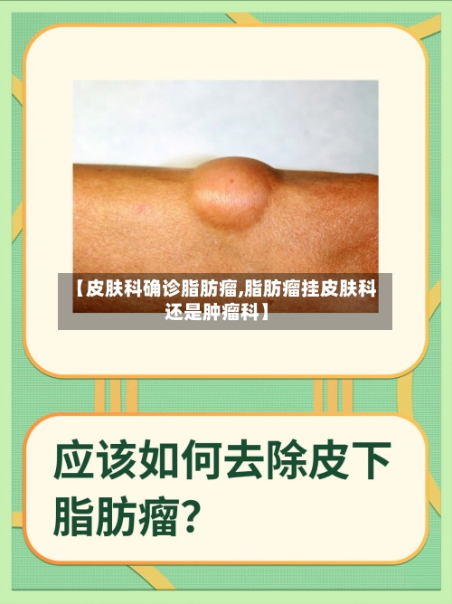 【皮肤科确诊脂肪瘤,脂肪瘤挂皮肤科还是肿瘤科】-第2张图片