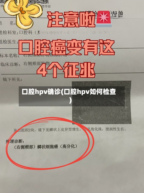 口腔hpv确诊(口腔hpv如何检查)-第3张图片