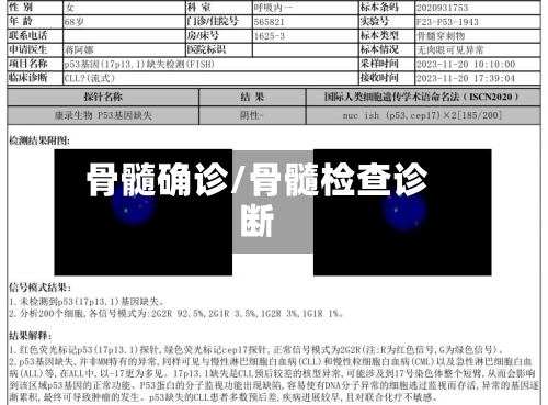 骨髓确诊/骨髓检查诊断