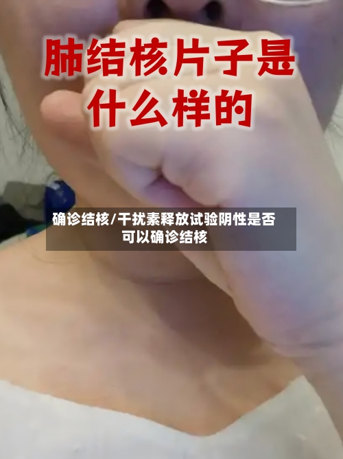确诊结核/干扰素释放试验阴性是否可以确诊结核-第3张图片