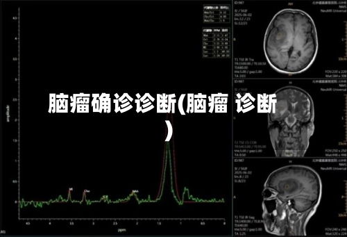 脑瘤确诊诊断(脑瘤 诊断)-第2张图片