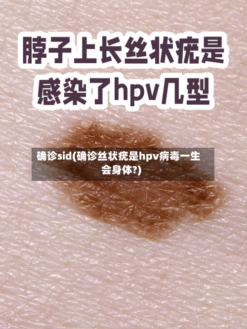 确诊sid(确诊丝状疣是hpv病毒一生会身体?)-第2张图片