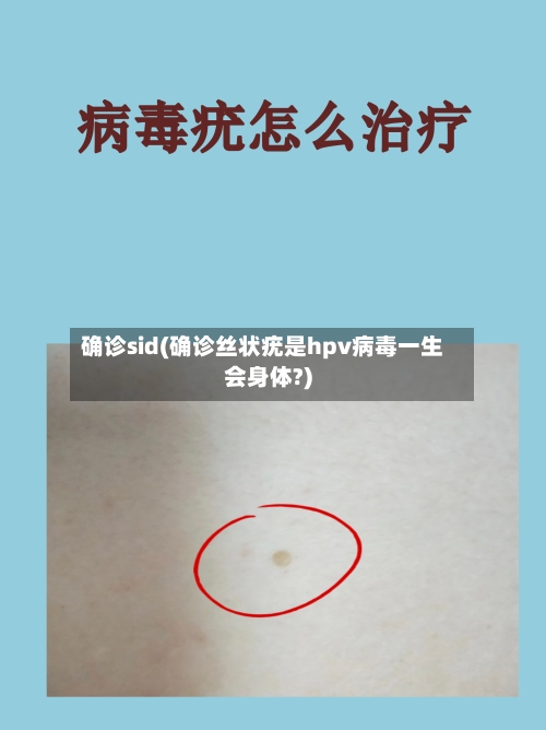 确诊sid(确诊丝状疣是hpv病毒一生会身体?)