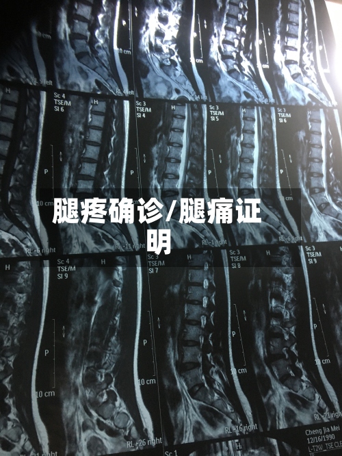 腿疼确诊/腿痛证明-第2张图片