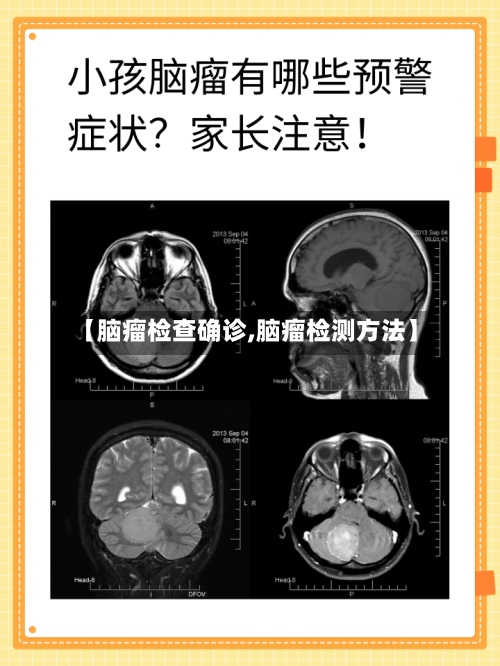 【脑瘤检查确诊,脑瘤检测方法】