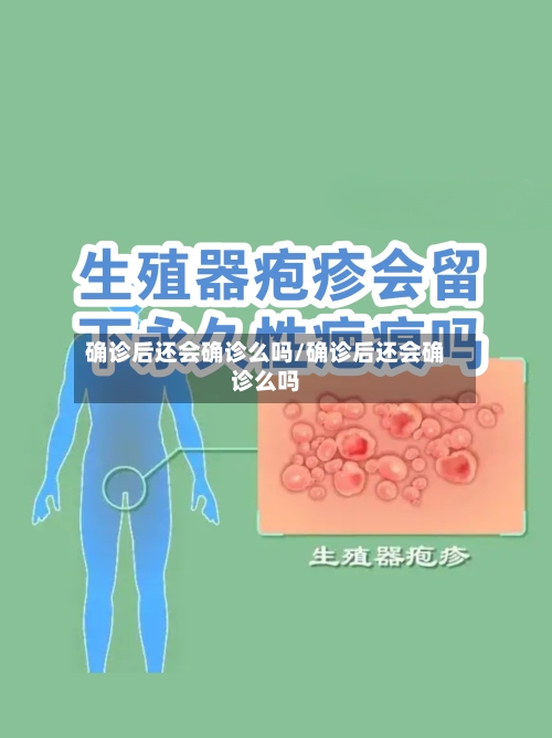 确诊后还会确诊么吗/确诊后还会确诊么吗