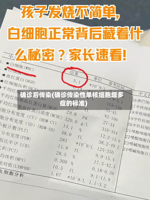 确诊后传染(确诊传染性单核细胞增多症的标准)