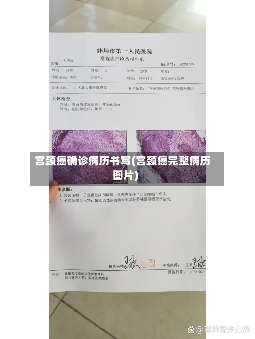 宫颈癌确诊病历书写(宫颈癌完整病历图片)
