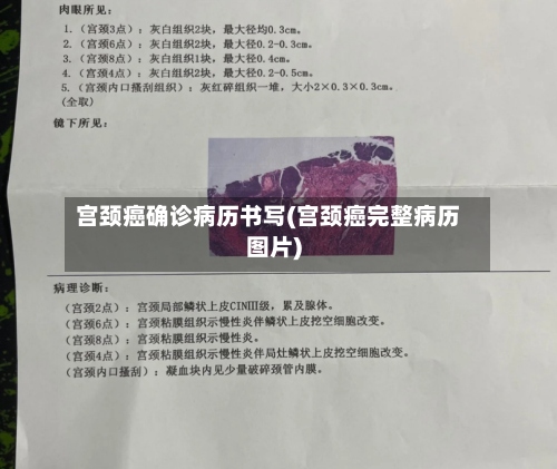 宫颈癌确诊病历书写(宫颈癌完整病历图片)-第3张图片