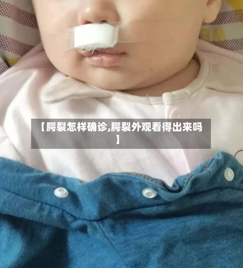 【腭裂怎样确诊,腭裂外观看得出来吗】
