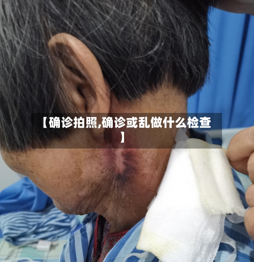 【确诊拍照,确诊或乱做什么检查】