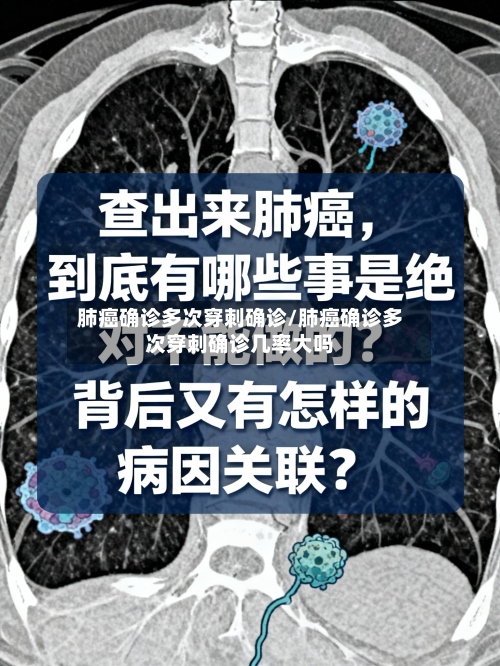 肺癌确诊多次穿刺确诊/肺癌确诊多次穿刺确诊几率大吗-第2张图片
