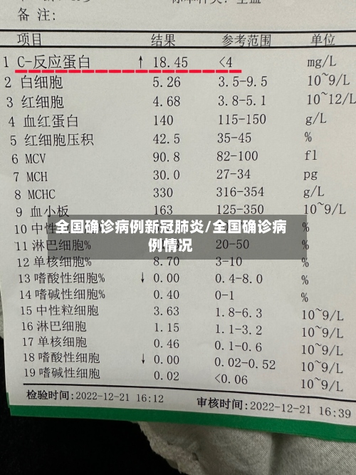 全国确诊病例新冠肺炎/全国确诊病例情况
