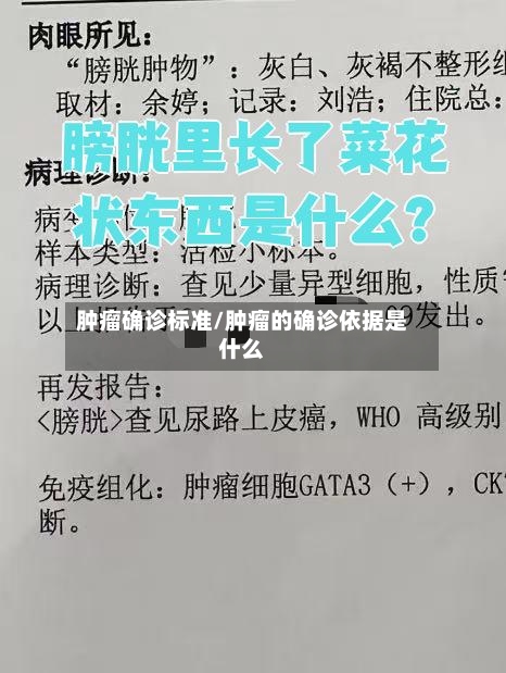 肿瘤确诊标准/肿瘤的确诊依据是什么