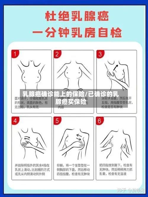 乳腺癌确诊能上的保险/已确诊的乳腺癌买保险-第3张图片