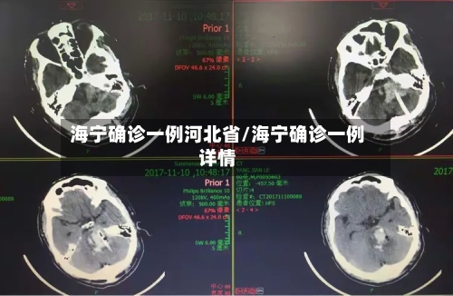 海宁确诊一例河北省/海宁确诊一例详情-第3张图片