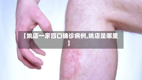 【姚店一家四口确诊病例,姚店是哪里】-第3张图片