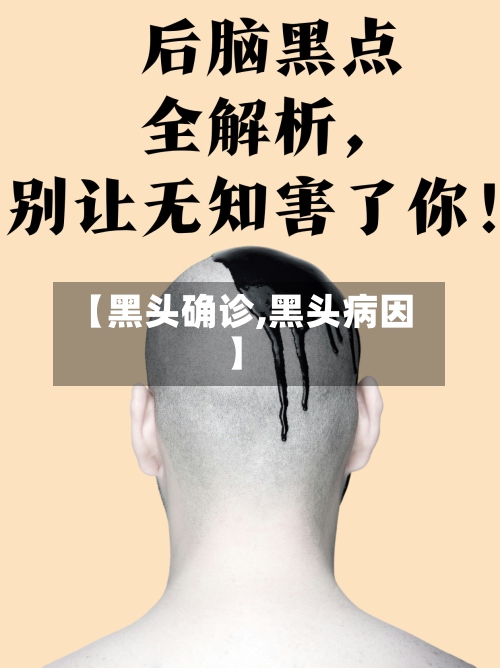 【黑头确诊,黑头病因】