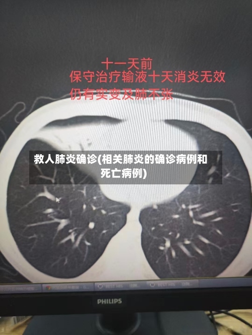 救人肺炎确诊(相关肺炎的确诊病例和死亡病例)