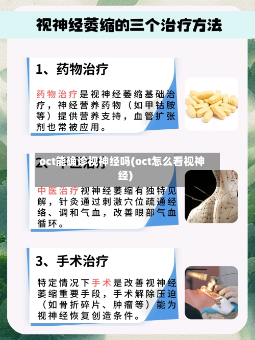 oct能确诊视神经吗(oct怎么看视神经)