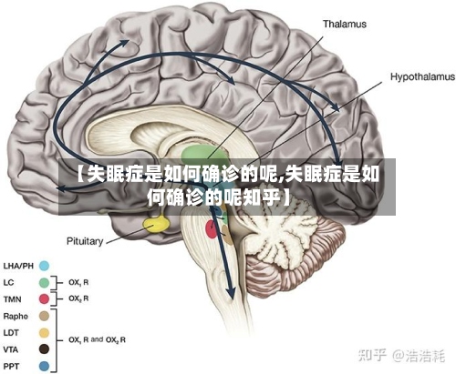 【失眠症是如何确诊的呢,失眠症是如何确诊的呢知乎】
