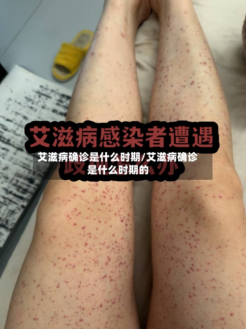 艾滋病确诊是什么时期/艾滋病确诊是什么时期的-第2张图片