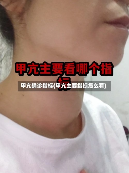 甲亢确诊指标(甲亢主要指标怎么看)