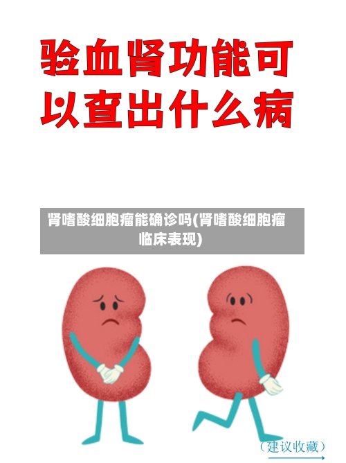 肾嗜酸细胞瘤能确诊吗(肾嗜酸细胞瘤临床表现)-第2张图片