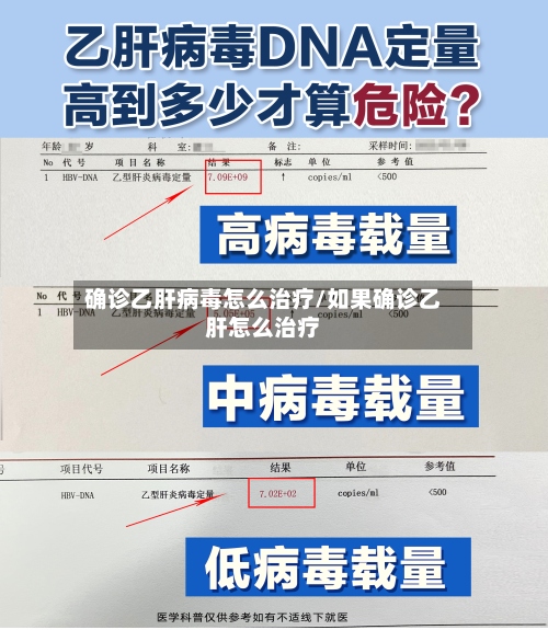 确诊乙肝病毒怎么治疗/如果确诊乙肝怎么治疗-第3张图片