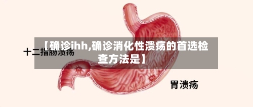【确诊ihh,确诊消化性溃疡的首选检查方法是】-第2张图片