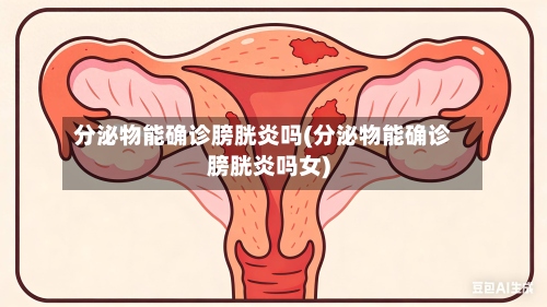 分泌物能确诊膀胱炎吗(分泌物能确诊膀胱炎吗女)