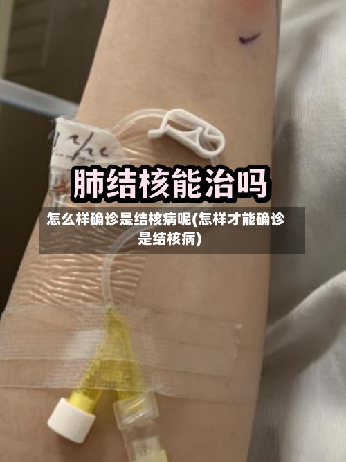 怎么样确诊是结核病呢(怎样才能确诊是结核病)-第2张图片